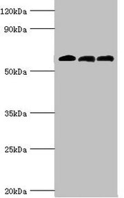 Western blot All lanes: 4-aminobutyrate aminotransferase, mitochondrial antibody at 10ug/ml Lane 1: Rat liver tissue Lane 2: Mouse pancreatic tissue Lane 3: Mouse kidney tissue Secondary Goat polyclonal to rabbit IgG at 1/10000 dilution Predicted...