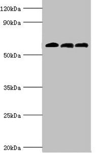 Western blot All lanes: 4-aminobutyrate aminotransferase, mitochondrial antibody at 10ug/ml Lane 1: Rat liver tissue Lane 2: Mouse pancreatic tissue Lane 3: Mouse kidney tissue Secondary Goat polyclonal to rabbit IgG at 1/10000 dilution Predicted...