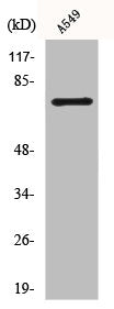 Western Blot analysis of A549 cells using Bmx Polyclonal Antibody