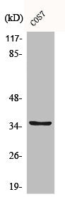 Western Blot analysis of Jurkat cells using BST-1 Polyclonal Antibody