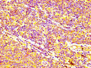 IHC image of CSB-PA001064LA01HU diluted at 1:400 and staining in paraffin-embedded human lymph node tissue performed on a Leica BondTM system. After dewaxing and hydration, antigen retrieval was mediated by high pressure in a citrate buffer (pH 6....