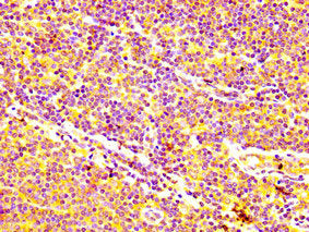 IHC image of CSB-PA001064LA01HU diluted at 1:400 and staining in paraffin-embedded human lymph node tissue performed on a Leica BondTM system. After dewaxing and hydration, antigen retrieval was mediated by high pressure in a citrate buffer (pH 6....