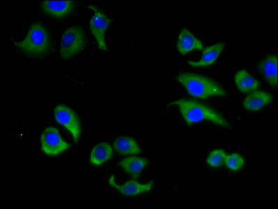 Immunofluorescence staining of A549 cells with CSB-PA001065LA01HU at 1:133, counter-stained with DAPI. The cells were fixed in 4% formaldehyde, permeabilized using 0.2% Triton X-100 and blocked in 10% normal Goat Serum. The cells were then incubat...