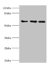 Western blot All lanes: ABCE1 antibody at 4ug/ml Lane 1: 293T whole cell lysate Lane 2: Hela whole cell lysate Lane 3: k562 whole cell lysate Secondary Goat polyclonal to rabbit IgG at 1/10000 dilution Predicted band size: 67 kDa Observed band siz...