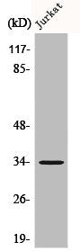 Western Blot analysis of Jurkat cells using C/EBP ε Polyclonal Antibody
