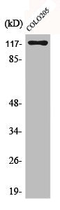 Western Blot analysis of COLO205 cells using C/EBP ζ Polyclonal Antibody