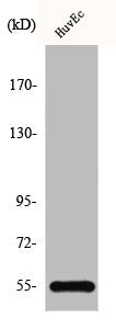 Western Blot analysis of HuvEc cells using C1INH Polyclonal Antibody