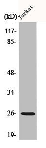 Western Blot analysis of Jurkat cells using C1q-B Polyclonal Antibody