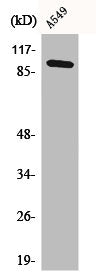 Western Blot analysis of HuvEc cells using C6 Polyclonal Antibody