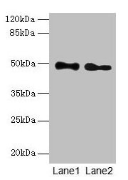 Western blot All lanes: ABHD2 antibody at 10µg/ml Lane 1: Mouse heart tissue Lane 2: Rat gonadal tissue Secondary Goat polyclonal to rabbit IgG at 1/10000 dilution Predicted band size: 49 kDa Observed band size: 49 kDa