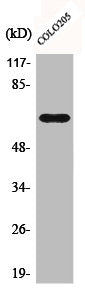 Western Blot analysis of COLO205 cells using C9 Polyclonal Antibody