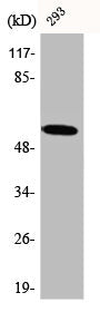 Western Blot analysis of 293 cells using CA IX Polyclonal Antibody