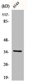 Western Blot analysis of K562 cells using CA VA Polyclonal Antibody