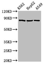 Western Blot Positive WB detected in: K562 whole cell lysate, HepG2 whole cell lysate, A549 whole cell lysate All lanes: HSP90AB1 antibody at 2µg/ml Secondary Goat polyclonal to rabbit IgG at 1/50000 dilution Predicted band size: 84 kDa Observed b...