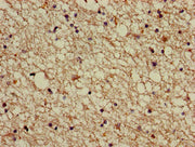 Immunohistochemistry of paraffin-embedded human brain tissue using CSB-PA001102LA01HU at dilution of 1:100