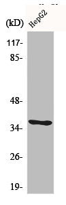 Western Blot analysis of LOVO cells using CA VI Polyclonal Antibody