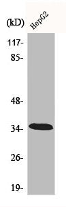 Western Blot analysis of HepG2 cells using CA XIII Polyclonal Antibody