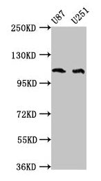 Western Blot Positive WB detected in: U87 whole cell lysate, U251 whole cell lysate All lanes: ABL2 antibody at 4µg/ml Secondary Goat polyclonal to rabbit IgG at 1/50000 dilution Predicted band size: 129, 125, 127, 115, 118, 116, 117, 61 kDa Obser...