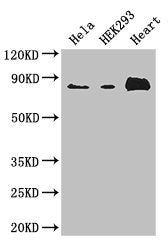 Western Blot Positive WB detected in: Hela whole cell lysate, HEK293 whole cell lysate, Mouse heart tissue All lanes: ABLIM1 antibody at 3.4ug/ml Secondary Goat polyclonal to rabbit IgG at 1/50000 dilution Predicted band size: 88, 82, 49, 47, 53,...