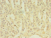 Immunohistochemistry of paraffin-embedded human adrenal gland tissue using CSB-PA001109LA01HU at dilution of 1:100