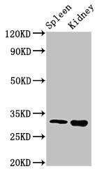 Western Blot Positive WB detected in: Mouse spleen tissue, Mouse kidney tissue All lanes: ABT1 antibody at 3ug/ml Secondary Goat polyclonal to rabbit IgG at 1/50000 dilution Predicted band size: 32 kDa Observed band size: 32 kDa