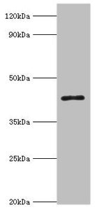 Western blot All lanes: 3-ketoacyl-CoA thiolase, peroxisomal antibody at 8ug/ml + Mouse liver tissue Secondary Goat polyclonal to rabbit IgG at 1/10000 dilution Predicted band size: 45, 35 kDa Observed band size: 45 kDa