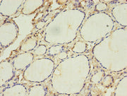 Immunohistochemistry of paraffin-embedded human thyroid tissue using CSB-PA001117LA01HU at dilution of 1:100