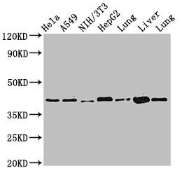 Western Blot Positive WB detected in: Hela whole cell lysate, A549 whole cell lysate, NIH/3T3 whole cell lysate, HepG2 whole cell lysate, Rat lung tissue, Mouse liver tissue, Mouse lung tissue All lanes: ACAA2 antibody at 2.4µg/ml Secondary Goat p...