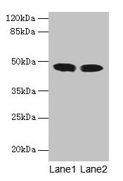 Western blot All lanes: ACADL antibody at 8µg/ml Lane 1: Mouse kidney tissue Lane 2: Mouse heart tissue Secondary Goat polyclonal to rabbit IgG at 1/10000 dilution Predicted band size: 48 kDa Observed band size: 48 kDa