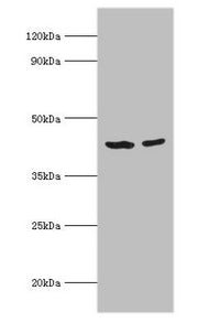 Western blot All lanes: Short-chain specific acyl-CoA dehydrogenase, mitochondrial antibody at 7ug/ml Lane 1: 293T whole cell lysate Lane 2: HepG2 whole cell lysate Secondary Goat polyclonal to rabbit IgG at 1/10000 dilution Predicted band size: 4...