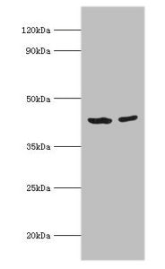 Western blot All lanes: Short-chain specific acyl-CoA dehydrogenase, mitochondrial antibody at 7ug/ml Lane 1: 293T whole cell lysate Lane 2: HepG2 whole cell lysate Secondary Goat polyclonal to rabbit IgG at 1/10000 dilution Predicted band size: 4...