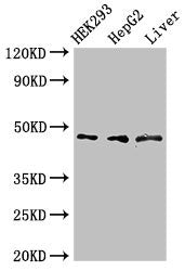 Western Blot Positive WB detected in: HEK293 whole cell lysate, HepG2 whole cell lysate, Rat liver tissue All lanes: ACADSB antibody at 3µg/ml Secondary Goat polyclonal to rabbit IgG at 1/50000 dilution Predicted band size: 48, 37 kDa Observed ban...