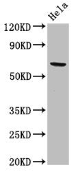 Western Blot Positive WB detected in: Hela whole cell lysate All lanes: ACADVL antibody at 2ug/ml Secondary Goat polyclonal to rabbit IgG at 1/50000 dilution Predicted band size: 71, 69, 73 kDa Observed band size: 71 kDa
