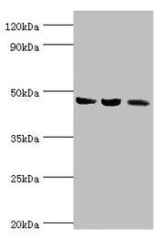 Western blot All lanes: ACAT1 antibody at 6µg/ml Lane 1: Mouse skeletal musce tissue Lane 2: Rat heart tissue Lane 3: THP-1 whole cell lysate Secondary Goat polyclonal to rabbit IgG at 1/10000 dilution Predicted band size: 46, 18 kDa Observed band...
