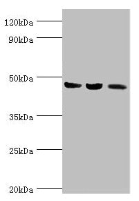 Western blot All lanes: ACAT1 antibody at 6µg/ml Lane 1: Mouse skeletal musce tissue Lane 2: Rat heart tissue Lane 3: THP-1 whole cell lysate Secondary Goat polyclonal to rabbit IgG at 1/10000 dilution Predicted band size: 46, 18 kDa Observed band...