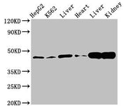 Western Blot Positive WB detected in: HepG2 whole cell lysate, K562 whole cell lysate, Rat liver tissue, Mouse heart tissue, Mouse liver tissue Mouse kindey tissue All lanes: ACAT1 antibody at 3µg/ml Secondary Goat polyclonal to rabbit IgG at 1/50...