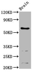 Western Blot Positive WB detected in: Mouse brain tissue All lanes: ASIC1 antibody at 4.24ug/ml Secondary Goat polyclonal to rabbit IgG at 1/50000 dilution Predicted band size: 60, 65, 63 kDa Observed band size: 60 kDa