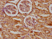 IHC image of CSB-PA001149LA01RA diluted at 1:400 and staining in paraffin-embedded rat kidney tissue performed on a Leica BondTM system. After dewaxing and hydration, antigen retrieval was mediated by high pressure in a citrate buffer (pH 6.0). Se...