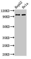 Western Blot Positive WB detected in: HepG2 whole cell lysate, Hela whole cell lysate All lanes: ACO1 antibody at 3µg/ml Secondary Goat polyclonal to rabbit IgG at 1/50000 dilution Predicted band size: 99 kDa Observed band size: 99 kDa