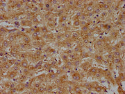 IHC image of CSB-PA001170LA01HU diluted at 1:100 and staining in paraffin-embedded human liver tissue performed on a Leica BondTM system. After dewaxing and hydration, antigen retrieval was mediated by high pressure in a citrate buffer (pH 6.0). S...