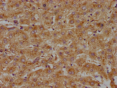 IHC image of CSB-PA001170LA01HU diluted at 1:100 and staining in paraffin-embedded human liver tissue performed on a Leica BondTM system. After dewaxing and hydration, antigen retrieval was mediated by high pressure in a citrate buffer (pH 6.0). S...