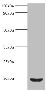 Western blot All lanes: Low molecular weight phosphotyrosine protein phosphatase antibody at 4ug/ml + HepG2 whole cell lysate Secondary Goat polyclonal to rabbit IgG at 1/10000 dilution Predicted band size: 19, 18, 15, 13 kDa Observed band size: 1...
