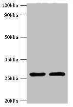 Positive WB detected in: K562 whole cell lysate(20µg), JK whole cell lysate(20µg), Raji whole cell lysate(20µg), Hela whole cell lysate(20µg), A549 whole cell lysate(20µg)
