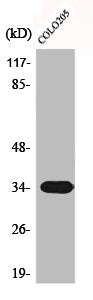 Western Blot analysis of COLO205 cells using Calponin 2 Polyclonal Antibody