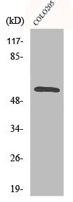 Western Blot analysis of Jurkat cells using CaMKIIβ/γ Polyclonal Antibody
