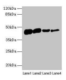 Western blot All lanes: ACTA1 antibody at 16µg/ml Lane 1: Rat heart tissue Lane 2: Mouse skeletal muscle tissue Lane 3: Human placenta tissue Lane 4: CEM whole cell lysate Secondary Goat polyclonal to rabbit IgG at 1/10000 dilution Predicted band...