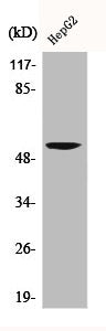 Western Blot analysis of HepG2 cells using CaMKV Polyclonal Antibody