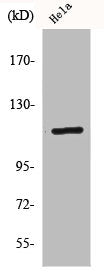 Western Blot analysis of HeLa cells using CARD 6 Polyclonal Antibody