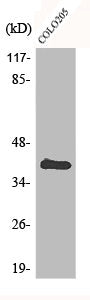 Western Blot analysis of COLO205 cells using CARP Polyclonal Antibody