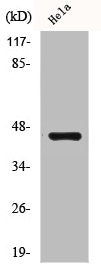 Western Blot analysis of Jurkat cells using Casein Kinase IIα Polyclonal Antibody